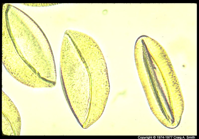 Image pollen  Magnolia grandiflora 24x--85.jpg