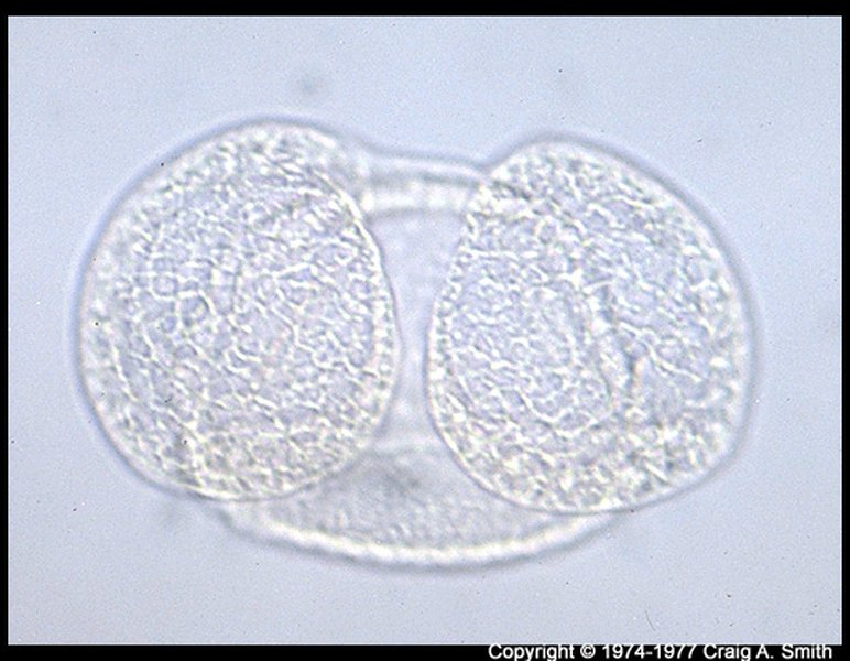 Image pollen Pinus strobus (Eastern white pine)--81.jpg