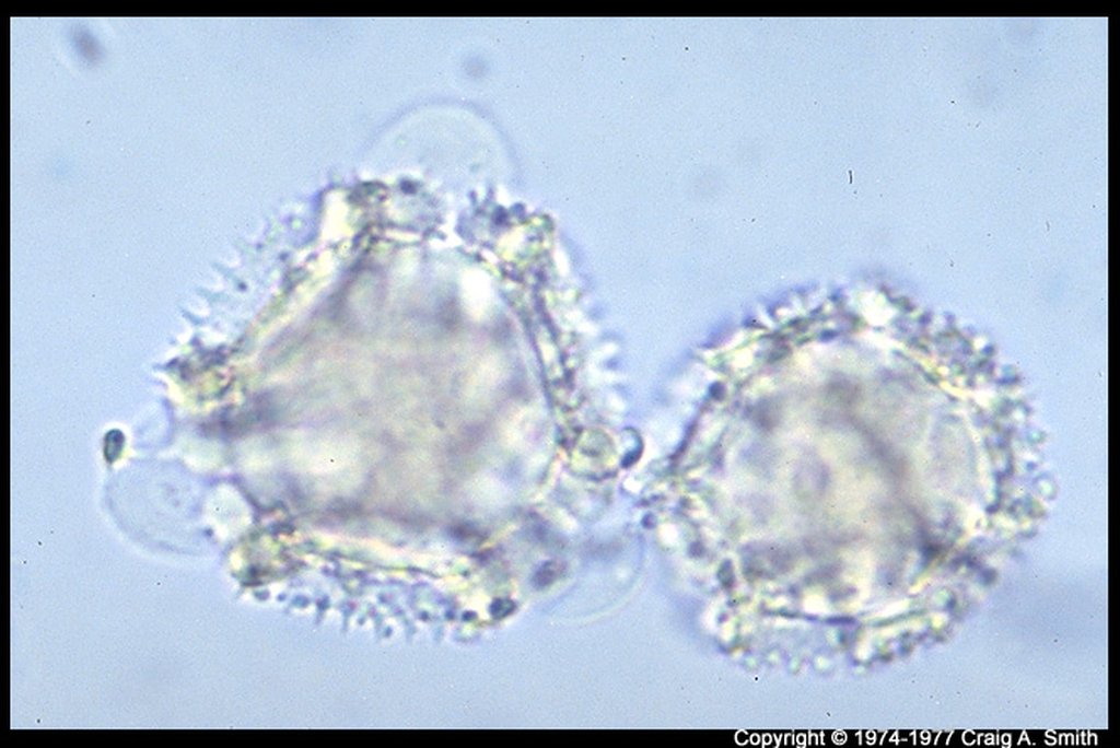 Image pollen Taraxacum vulgare (Dandelion) cross section--84.jpg