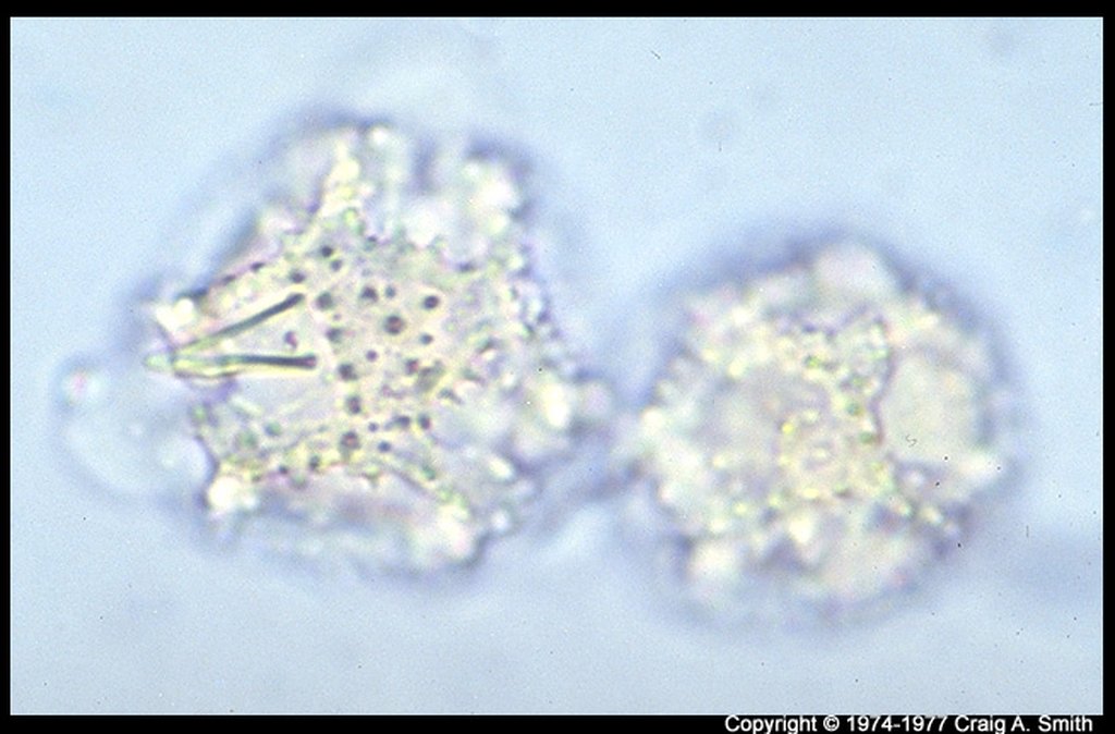 Image pollen Taraxacum vulgare (Dandelion) surface focus--83.jpg